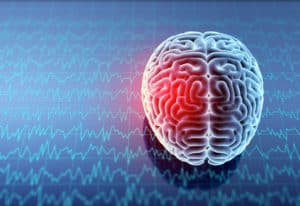 Subdural Hematoma Injury